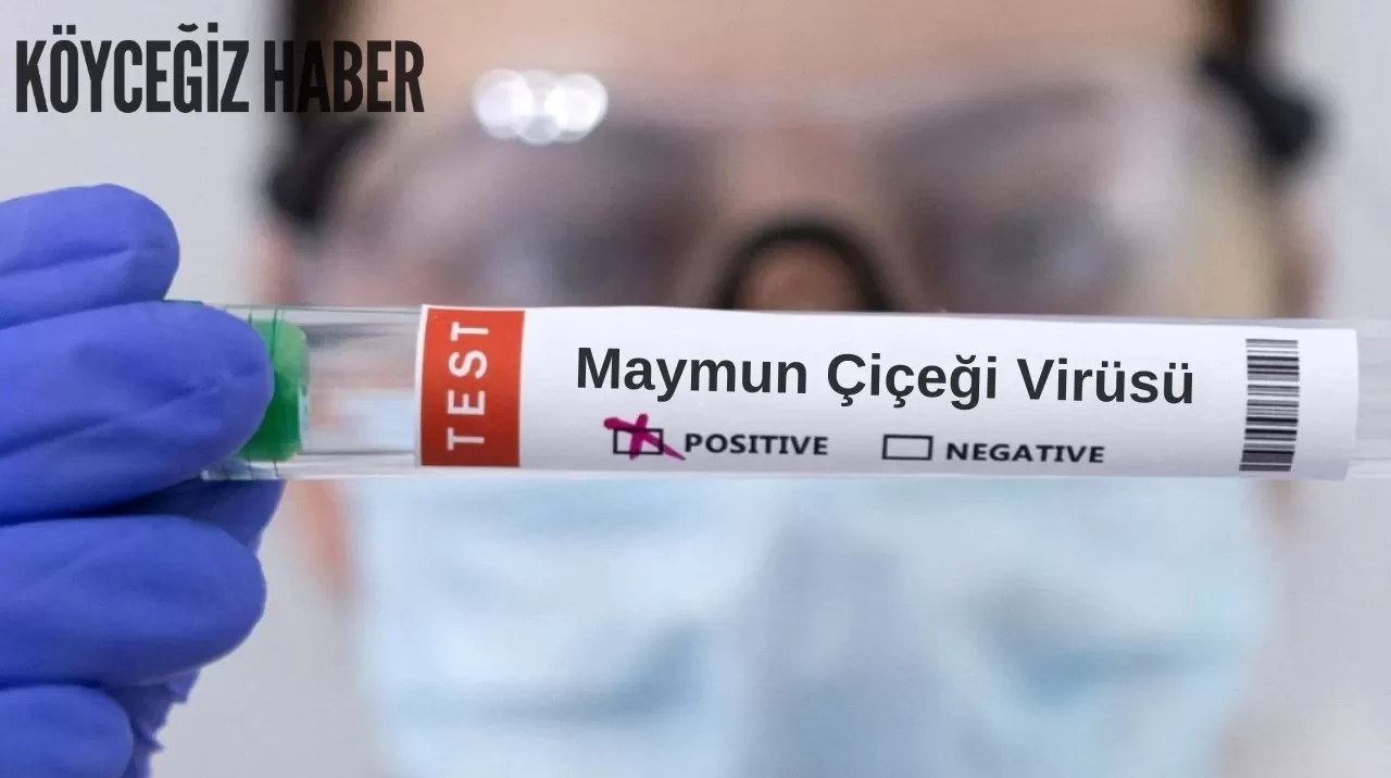 Maymun Çiçeği Virüsü: Riskleri Belirtileri ve Korunma Yöntemleri