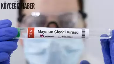 Maymun Çiçeği Virüsü: Riskleri Belirtileri ve Korunma Yöntemleri