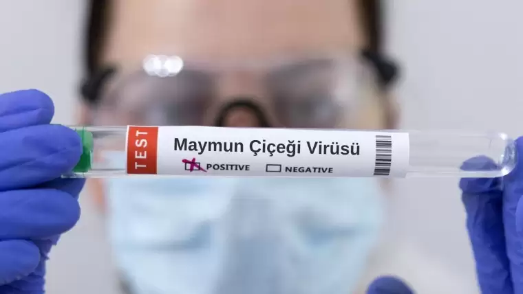 Maymun çiçeği virüsü nedir? (mpox nedir), ilk olarak Afrika'nın tropikal yağmur ormanlarında bulunan maymunlarda keşfedilen bir virüstür. Bu virüs, insanlara bulaşabilir ve genellikle ateş, baş ağrısı, kas ağrıları ve cilt döküntüleri gibi belirtilerle kendini gösterir. Çoğunlukla hafif seyreden bu enfeksiyon, nadiren ciddi sağlık sorunlarına yol açabilir. Ancak bağışıklık sistemi zayıf olan bireyler, yaşlılar ve çocuklar için risk daha yüksektir.